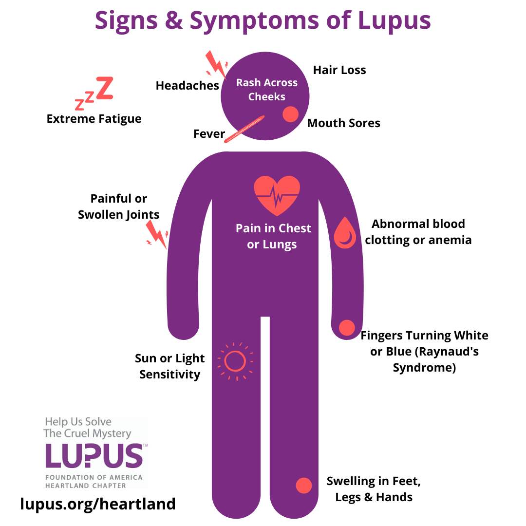 Raise Awareness Of Lupus Heartland Lupus Foundation Of America